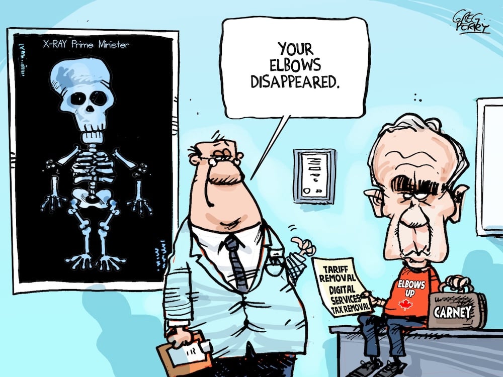 A political satire picture showing Mark Carney at the doctor's office, where the doctor shows him an X-Ray where Carney's elbows are shattered. The doctor says "You elbows disappeared". This is in reference to the "elbows up" campaign that Carney ran to be Prime Minister, on the premise that he'd stand up for Canada against the Trump government.
Source: https://thetyee.ca/Opinion/2025/08/28/Please-Advise-Where-Carney-Elbows/